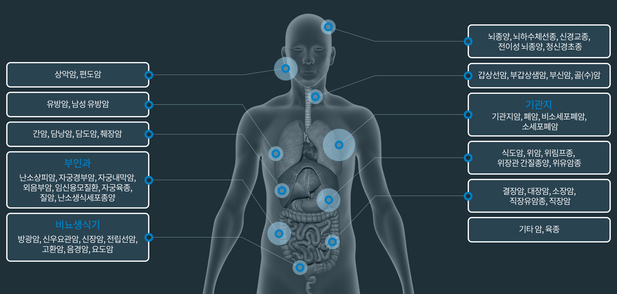 고주파온열치료기