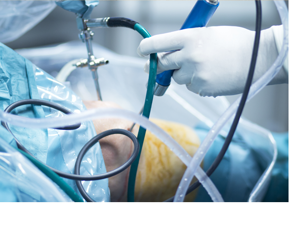 무릎수술후재활