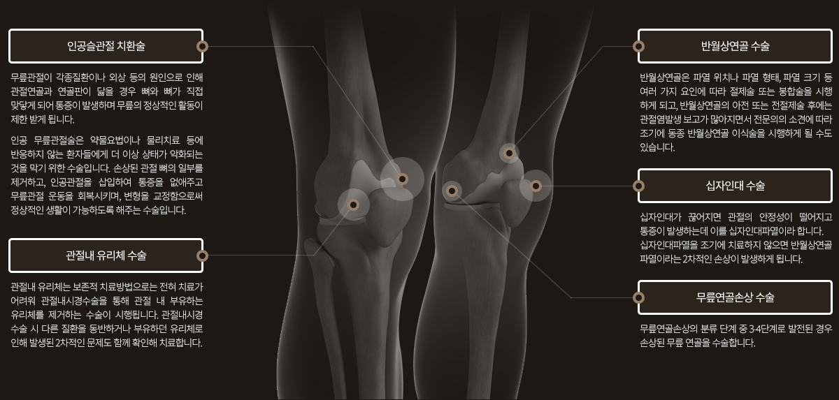 무릎수술후재활