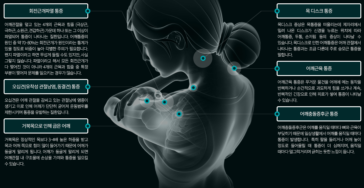 어깨 통증질환의 종류