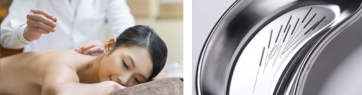 다양한 한방 침(針)치료