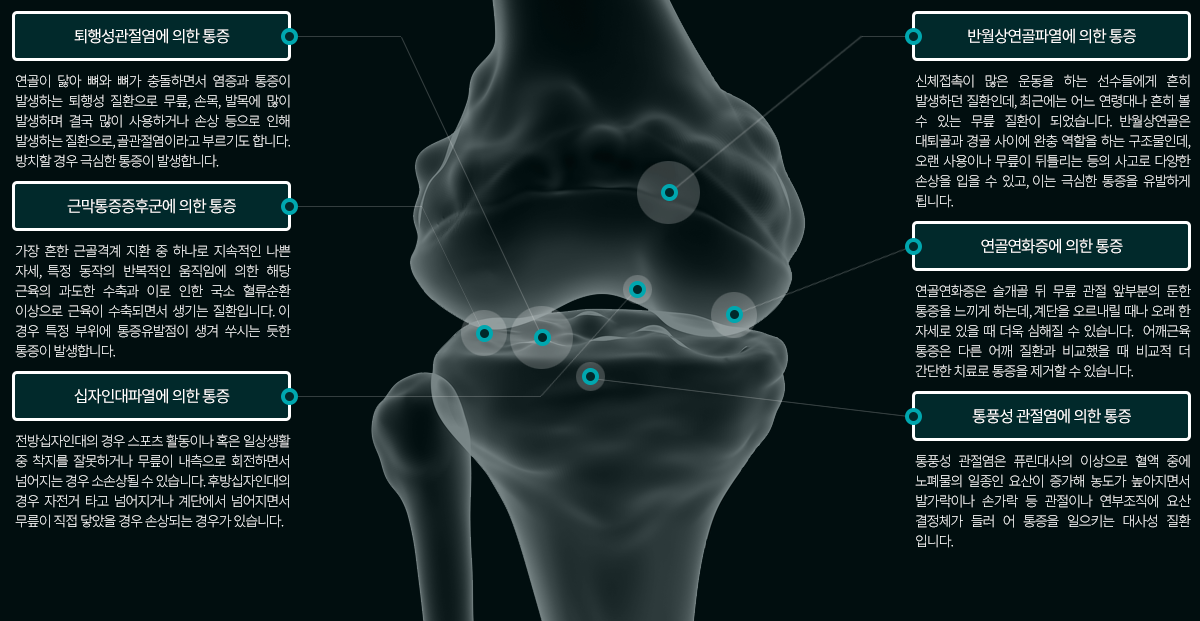 무릎 통증질환의 종류