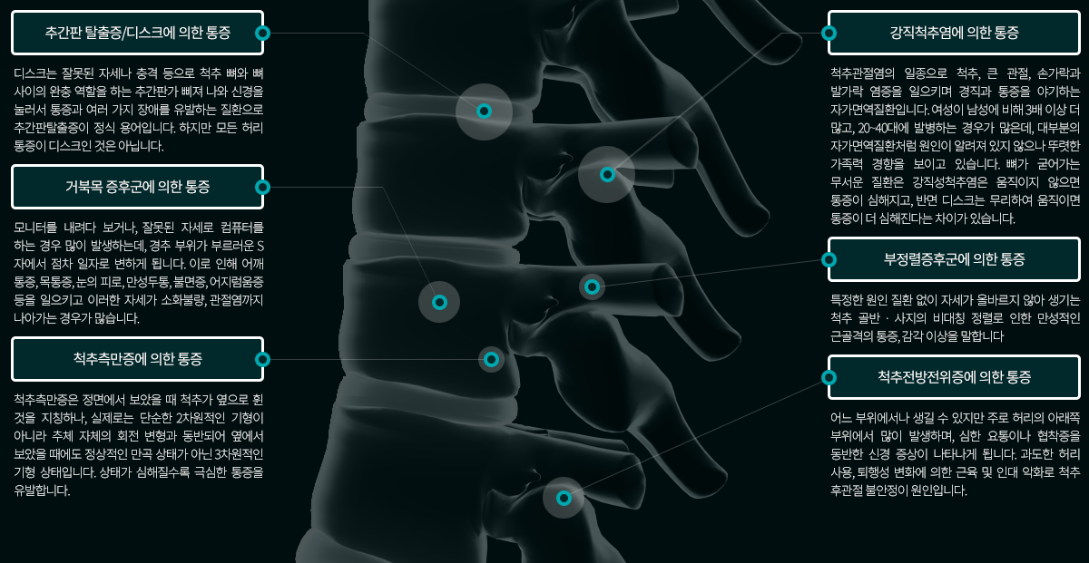 척추 통증질환의 종류