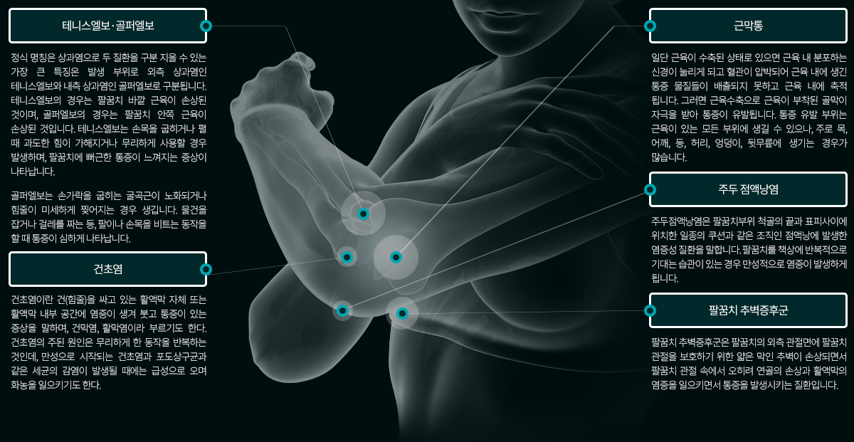 팔꿈치 통증질환의 종류