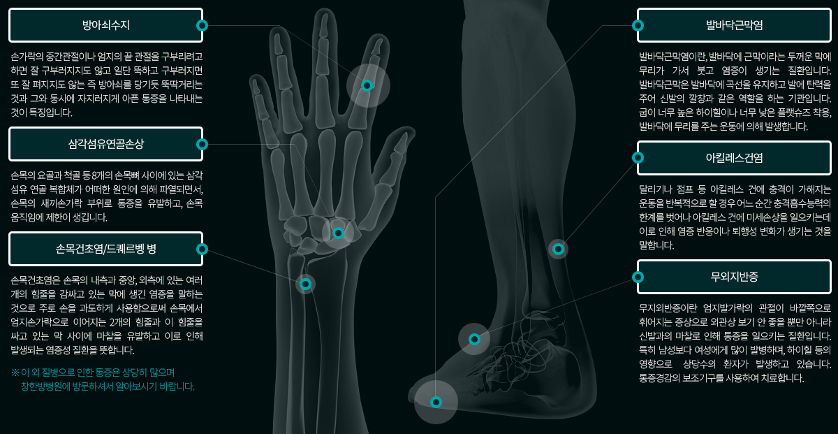 손·발 통증질환의 종류